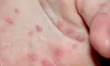 parboaboa